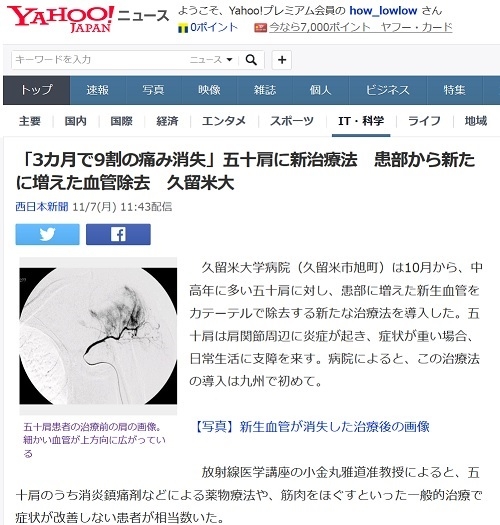 Yahoo ニュース 2016年11月7日